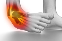 Symptoms of a Sprained Ankle