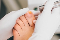 Understanding Types of Toenail Fungus and Treatment